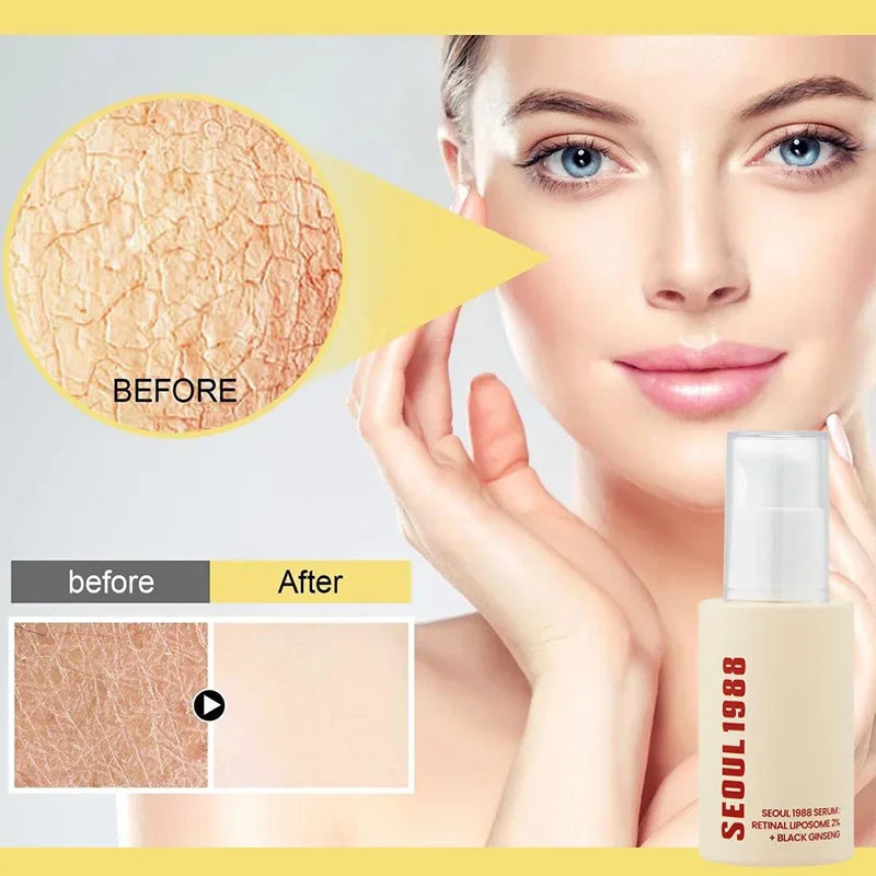 Seoul 1988 100ml Niacinamide 2% Retinal Ginseng Essence Firming Eye Cream Lightens Fine Lines Deep Moisturizing Care Essence Set