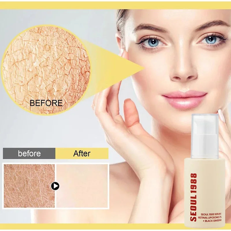 Seoul 1988 100ml Niacinamide 2% Retinal Ginseng Essence Firming Eye Cream Lightens Fine Lines Deep Moisturizing Care Essence Set